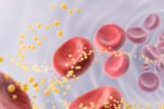 Ar tikrai visada reikia mažinti cholesterolį